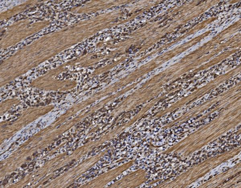 EIF5 Antibody