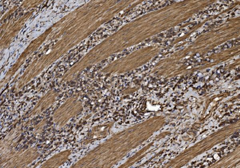 EIF5 Antibody