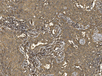 EIF5 Antibody