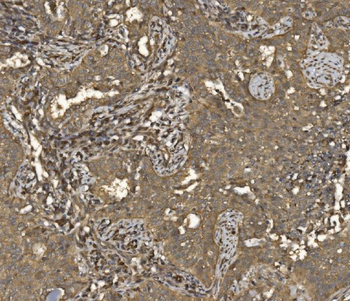 EIF5 Antibody