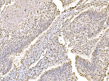c-Jun/JUN Antibody