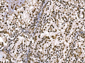 c-Jun/JUN Antibody