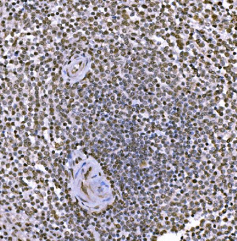 c-Jun/JUN Antibody