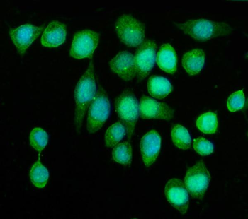 KIF2A Rabbit Polyclonal Antibody