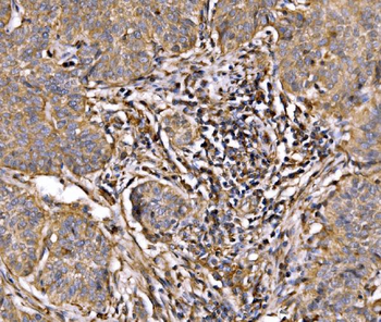 PI 3 Kinase p85 alpha/PIK3R1 Antibody