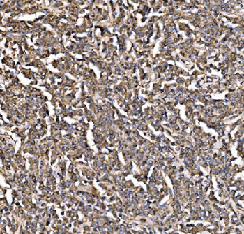 PI 3 Kinase p85 alpha/PIK3R1 Antibody