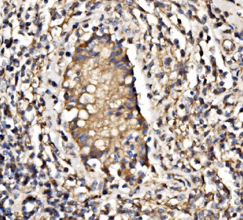 PI 3 Kinase p85 alpha/PIK3R1 Antibody