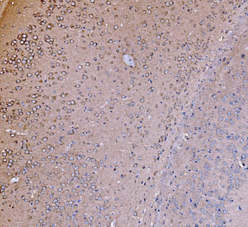 PI 3 Kinase p85 alpha/PIK3R1 Antibody