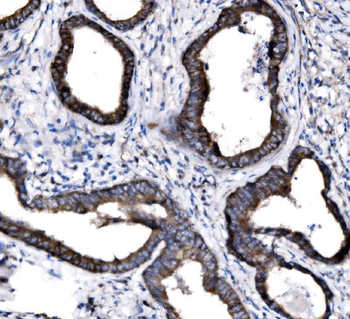NKCC1/SLC12A2 Rabbit Polyclonal Antibody