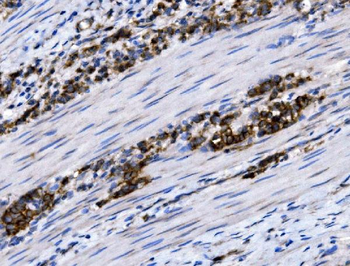 NKCC1/SLC12A2 Rabbit Polyclonal Antibody