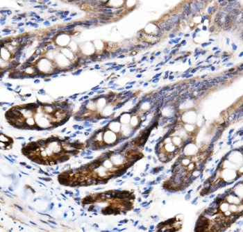 NKCC1/SLC12A2 Rabbit Polyclonal Antibody