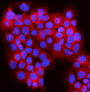 JLP/SPAG9 Antibody