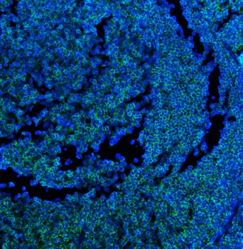 CD45 Mouse Monoclonal Antibody