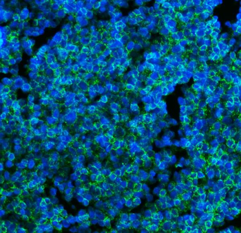 CD45 Mouse Monoclonal Antibody