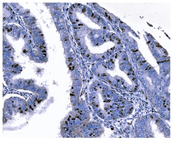 Ki67 Antibody (monoclonal, 5C7)