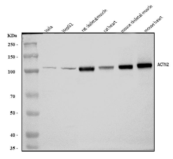 ACTN2 Rabbit Polyclonal Antibody