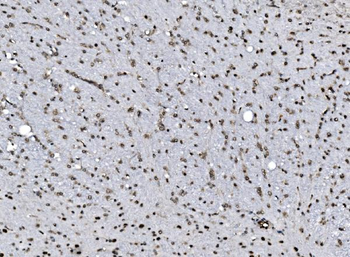 DBC-1/CCAR2 Antibody