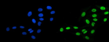 DBC-1/CCAR2 Antibody