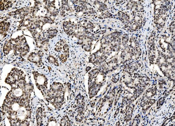 DBC-1/CCAR2 Antibody
