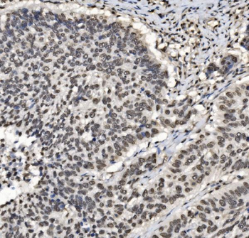 DBC-1/CCAR2 Antibody