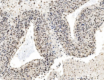DBC-1/CCAR2 Antibody
