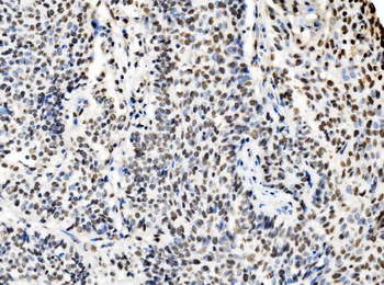 DBC-1/CCAR2 Antibody