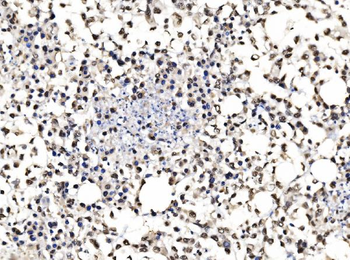 DBC-1/CCAR2 Antibody