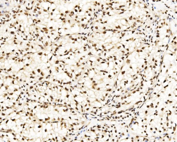 DBC-1/CCAR2 Antibody