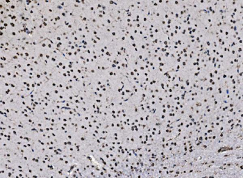 DBC-1/CCAR2 Antibody
