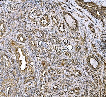 DLAT Antibody