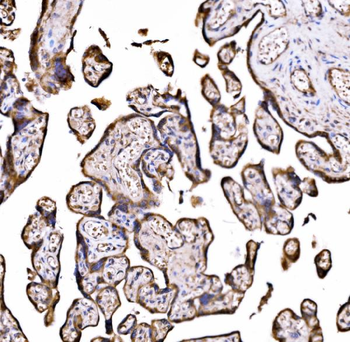 DLAT Antibody