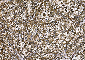 DLAT Antibody