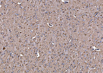 DLAT Antibody