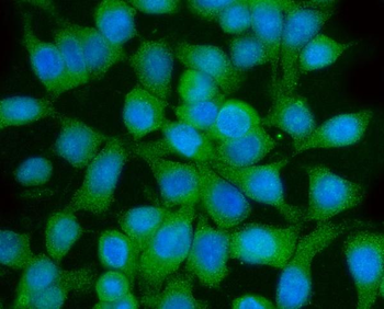 GGA3 Rabbit Polyclonal Antibody