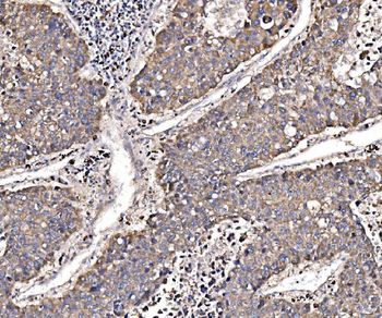 GGA3 Rabbit Polyclonal Antibody