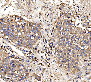 Gephyrin/GPHN Antibody