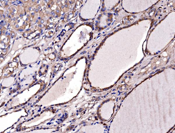 Gephyrin/GPHN Antibody