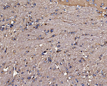 Gephyrin/GPHN Antibody