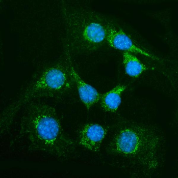 Alanine Transaminase/Gpt Rabbit Polyclonal Antibody