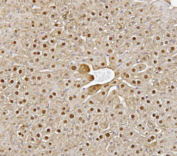 Alanine Transaminase/Gpt Rabbit Polyclonal Antibody