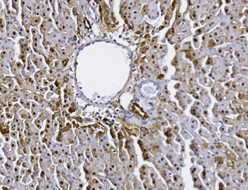 Alanine Transaminase/Gpt Rabbit Polyclonal Antibody
