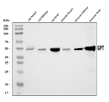 Alanine Transaminase/Gpt Rabbit Polyclonal Antibody