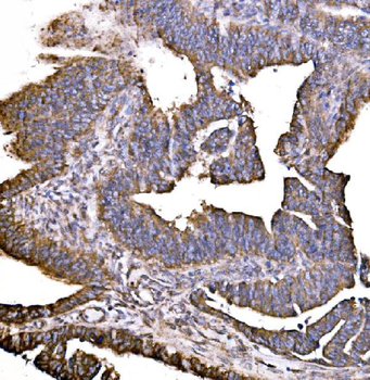 HIP1R Rabbit Polyclonal Antibody