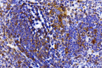 IL-2 Receptor alpha/Il2ra Antibody