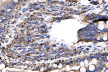 IL-2 Receptor alpha/Il2ra Antibody