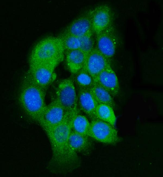 Integrin linked ILK Antibody