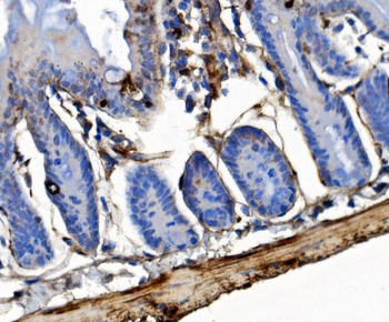 Integrin linked ILK Antibody