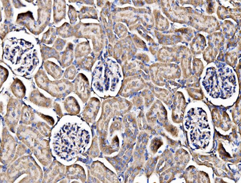 Integrin linked ILK Antibody