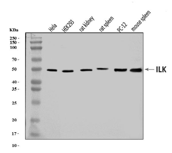 Integrin linked ILK Antibody