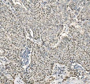 JUNB Antibody
